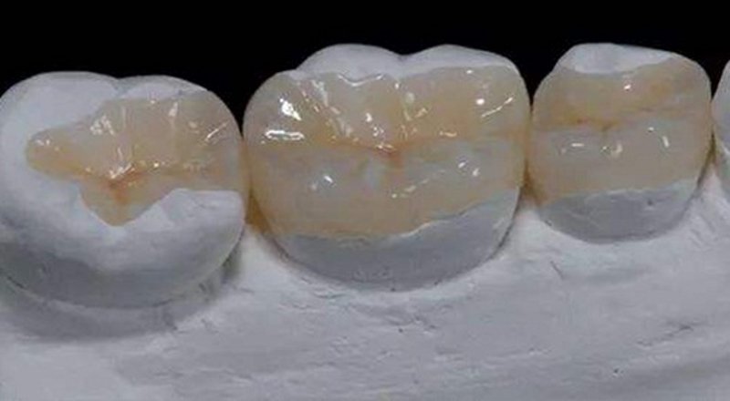 常熟牙科医疗新趋势：智慧口腔健康管理